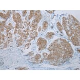 Immunohistochemistry - FGF6 Antibody from Signalway Antibody (43230) - Antibodies.com