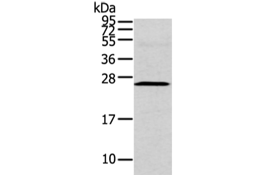 CFC1 Antibody from Signalway Antibody (43240) - Antibodies.com