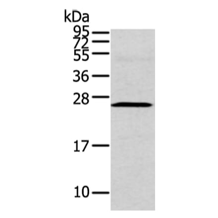 CFC1 Antibody from Signalway Antibody (43240) - Antibodies.com