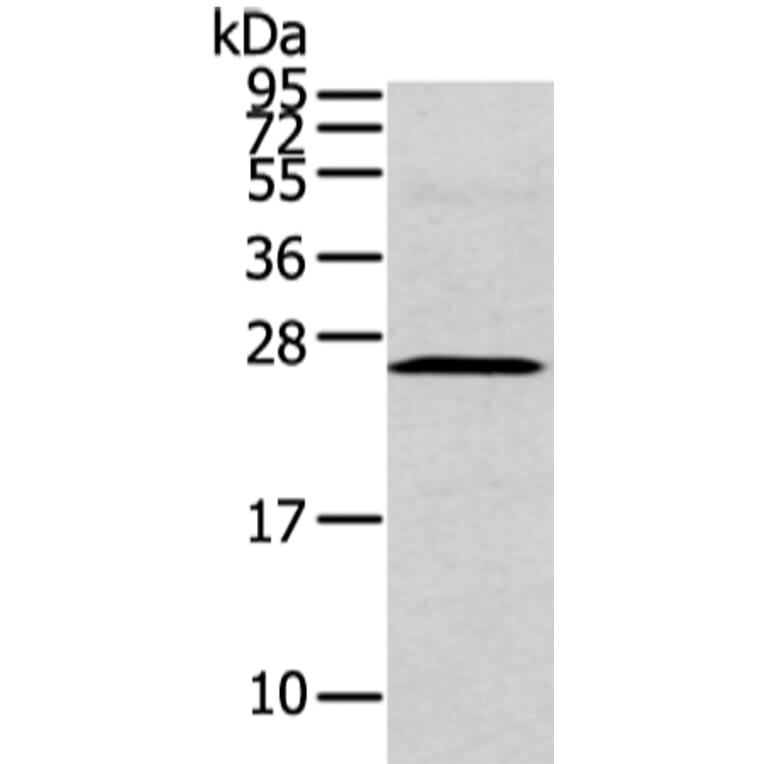 CFC1 Antibody from Signalway Antibody (43240) - Antibodies.com