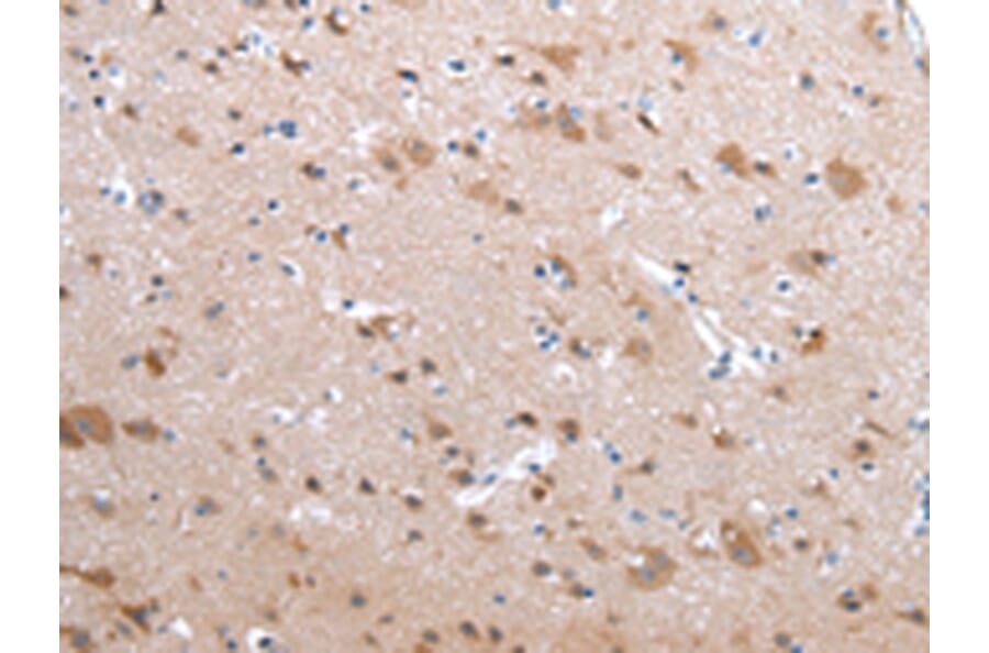 Immunohistochemistry - CFC1 Antibody from Signalway Antibody (43240) - Antibodies.com