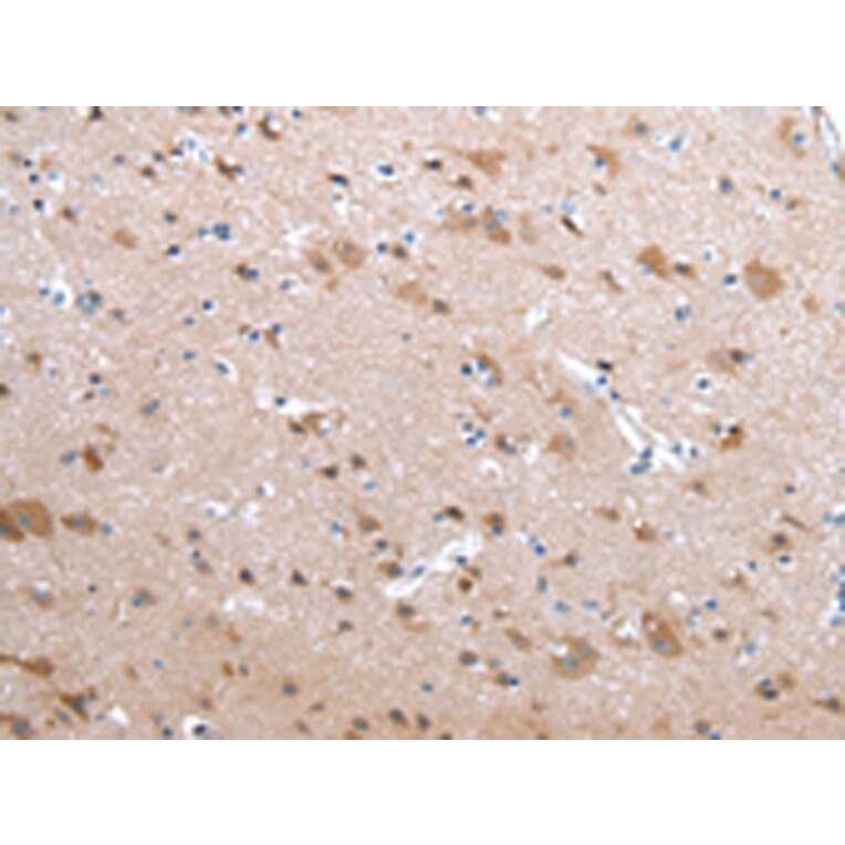 Immunohistochemistry - CFC1 Antibody from Signalway Antibody (43240) - Antibodies.com