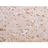 Immunohistochemistry - CFC1 Antibody from Signalway Antibody (43240) - Antibodies.com