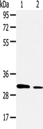 Gel: 6%SDS-PAGE Lysate: 40 &#956;g Lane 1-2: Hela and Jurkat cell Primary antibody: 1/400 dilution Secondary antibody: Goat anti rabbit IgG at 1/8000 dilution Exposure time: 2 minutes