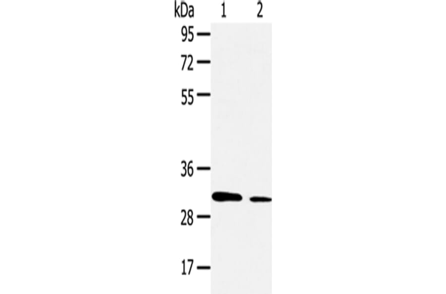 AQP9 Antibody from Signalway Antibody (43256) - Antibodies.com