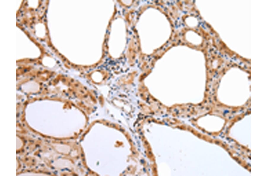 Immunohistochemistry - AQP9 Antibody from Signalway Antibody (43256) - Antibodies.com