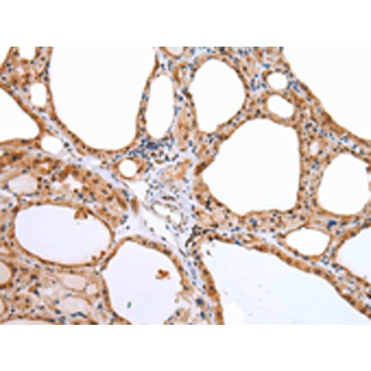 Immunohistochemistry - AQP9 Antibody from Signalway Antibody (43256) - Antibodies.com