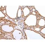 Immunohistochemistry - AQP9 Antibody from Signalway Antibody (43256) - Antibodies.com