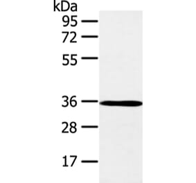 E2F5 Antibody from Signalway Antibody (43261) - Antibodies.com