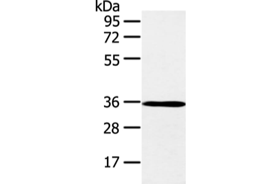 E2F5 Antibody from Signalway Antibody (43261) - Antibodies.com