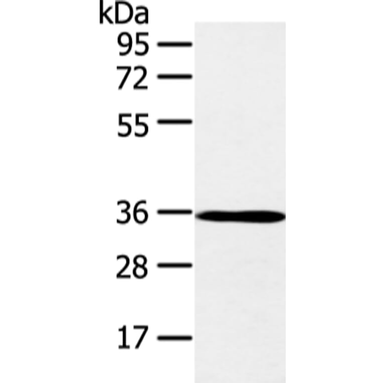 E2F5 Antibody from Signalway Antibody (43261) - Antibodies.com