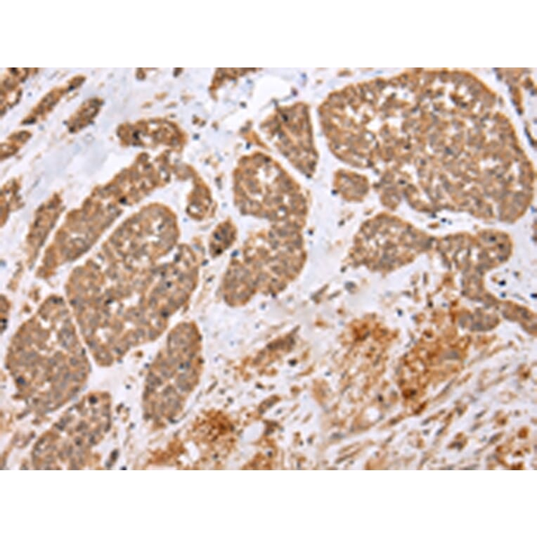Immunohistochemistry - E2F5 Antibody from Signalway Antibody (43261) - Antibodies.com