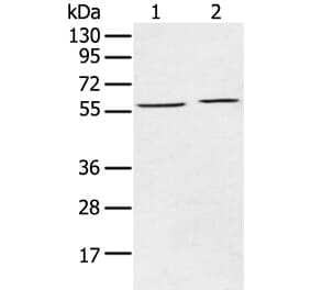 ECM1 Antibody from Signalway Antibody (43263) - Antibodies.com