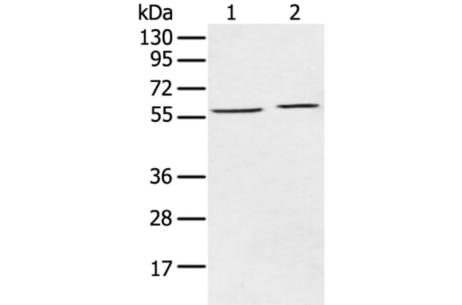 ECM1 Antibody from Signalway Antibody (43263) - Antibodies.com
