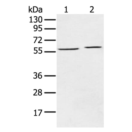 ECM1 Antibody from Signalway Antibody (43263) - Antibodies.com