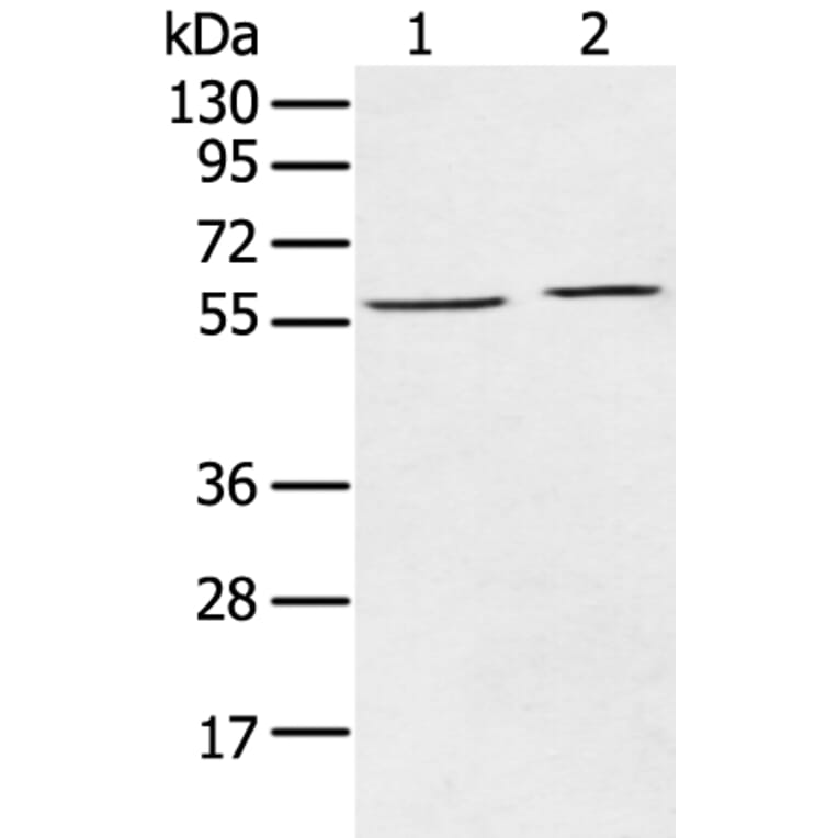 ECM1 Antibody from Signalway Antibody (43263) - Antibodies.com