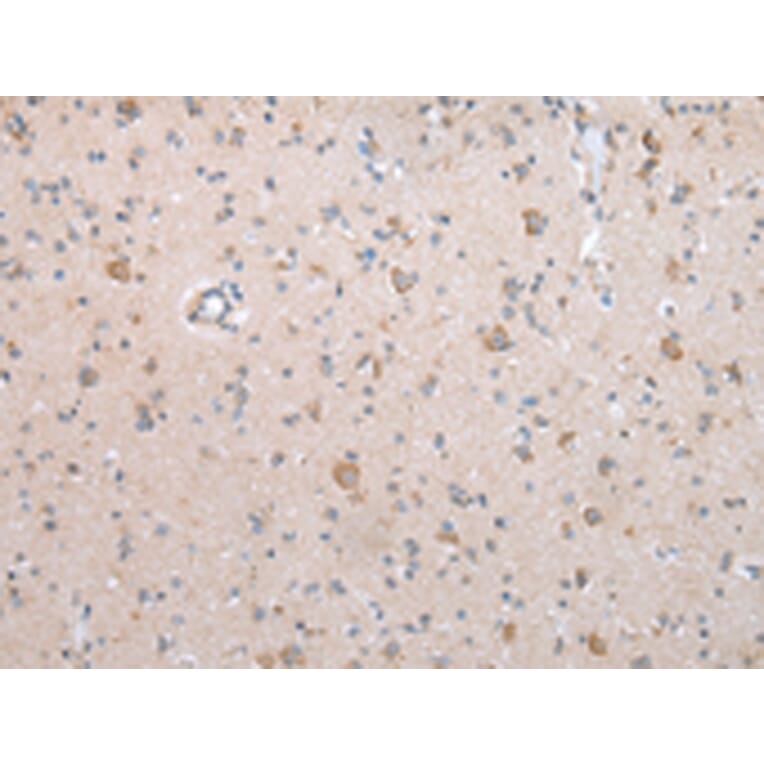 Immunohistochemistry - ECM1 Antibody from Signalway Antibody (43263) - Antibodies.com