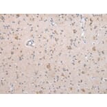 Immunohistochemistry - ECM1 Antibody from Signalway Antibody (43263) - Antibodies.com