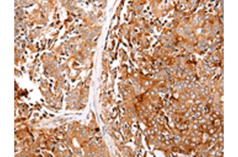 Immunohistochemistry - GPC1 Antibody from Signalway Antibody (43277) - Antibodies.com