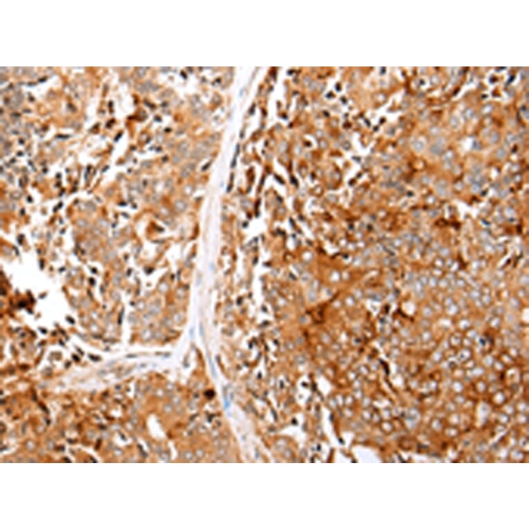 Immunohistochemistry - GPC1 Antibody from Signalway Antibody (43277) - Antibodies.com