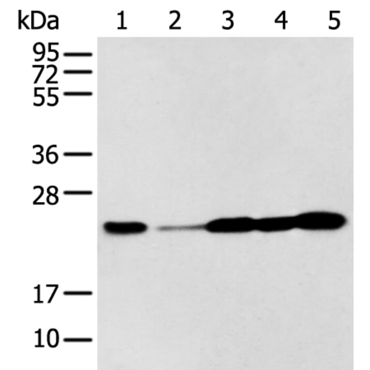 BAG2 Antibody from Signalway Antibody (43282) - Antibodies.com