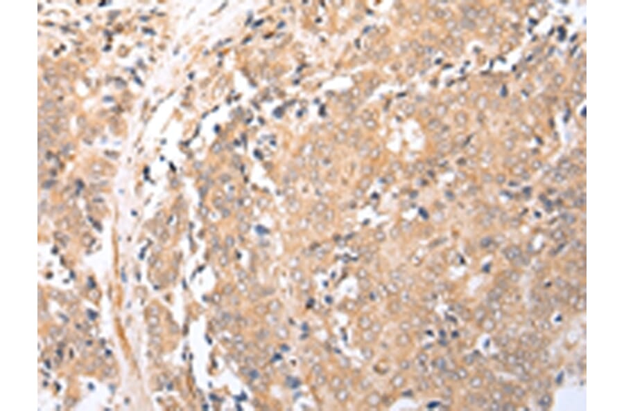 Immunohistochemistry - BAG2 Antibody from Signalway Antibody (43282) - Antibodies.com