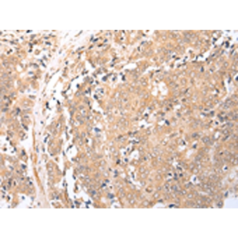 Immunohistochemistry - BAG2 Antibody from Signalway Antibody (43282) - Antibodies.com