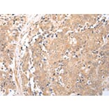 Immunohistochemistry - BAG2 Antibody from Signalway Antibody (43282) - Antibodies.com