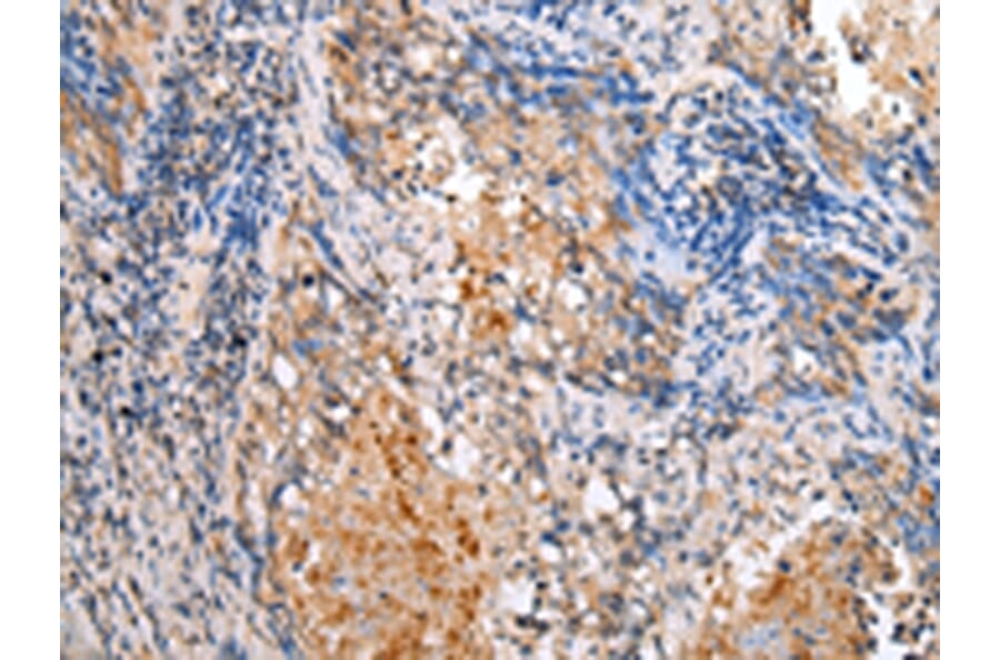 Immunohistochemistry - BAG2 Antibody from Signalway Antibody (43282) - Antibodies.com