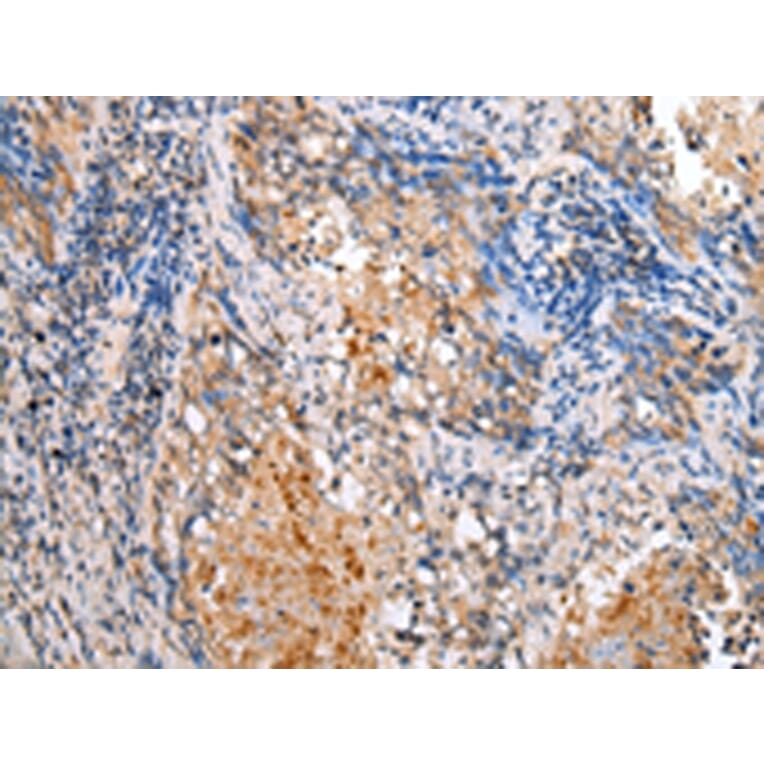 Immunohistochemistry - BAG2 Antibody from Signalway Antibody (43282) - Antibodies.com