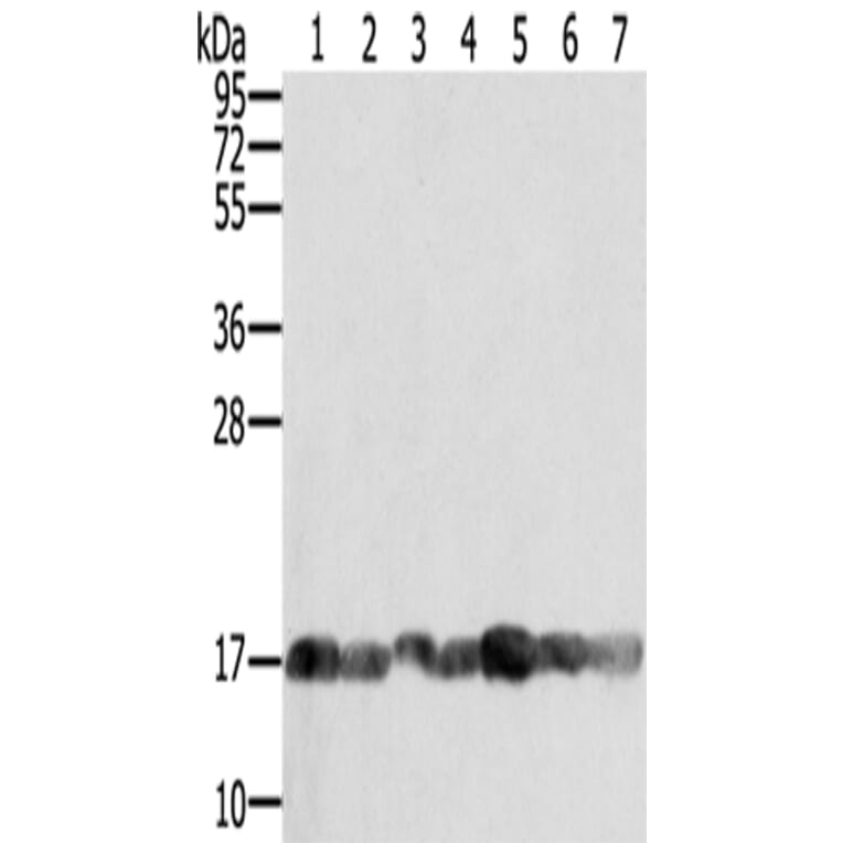 PPIA Antibody from Signalway Antibody (43321) - Antibodies.com