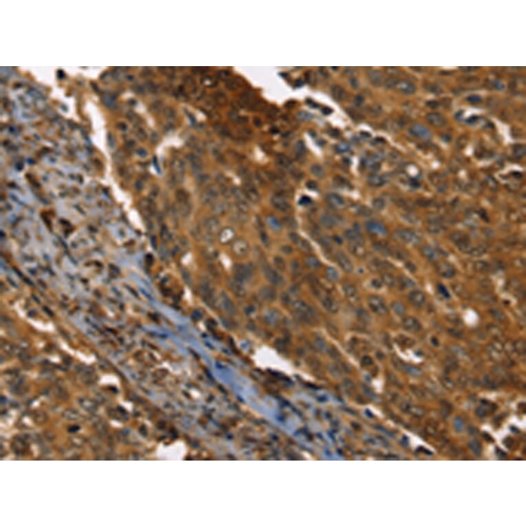 Immunohistochemistry - PPIA Antibody from Signalway Antibody (43321) - Antibodies.com