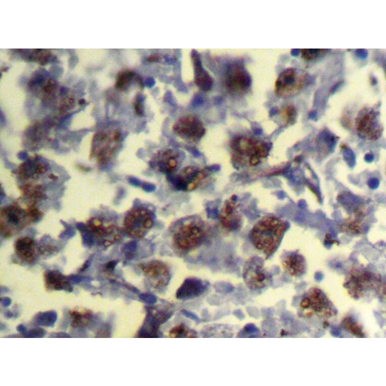 Immunohistochemistry - REC8 Antibody from Signalway Antibody (43324) - Antibodies.com