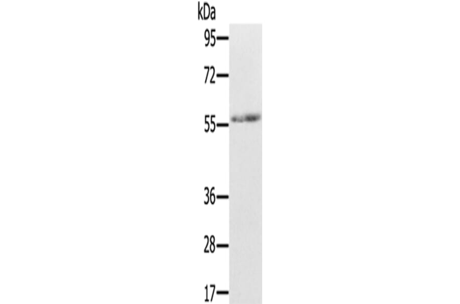 REC8 Antibody from Signalway Antibody (43324) - Antibodies.com