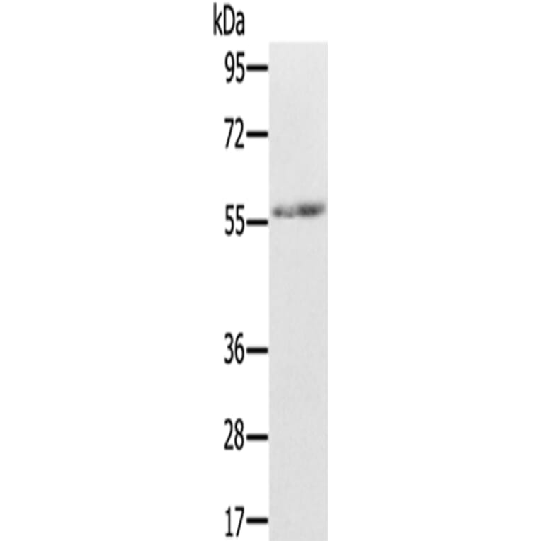 REC8 Antibody from Signalway Antibody (43324) - Antibodies.com