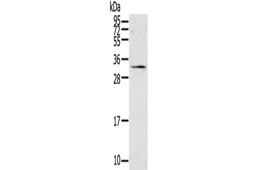 STAR Antibody from Signalway Antibody (43333) - Antibodies.com