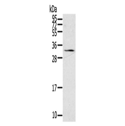 STAR Antibody from Signalway Antibody (43333) - Antibodies.com