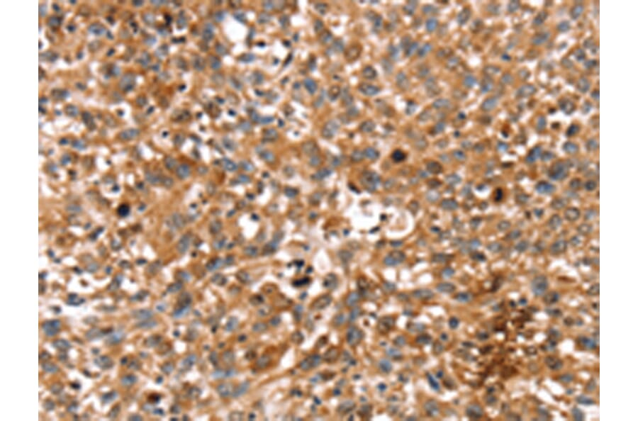 Immunohistochemistry - STAR Antibody from Signalway Antibody (43333) - Antibodies.com