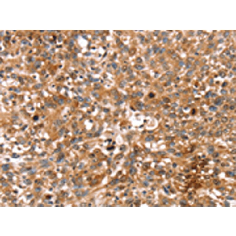 Immunohistochemistry - STAR Antibody from Signalway Antibody (43333) - Antibodies.com