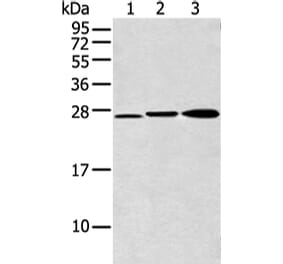 DCXR Antibody from Signalway Antibody (43354) - Antibodies.com