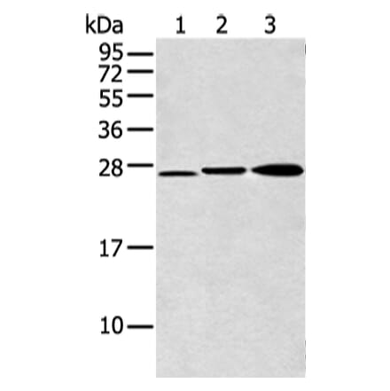 DCXR Antibody from Signalway Antibody (43354) - Antibodies.com