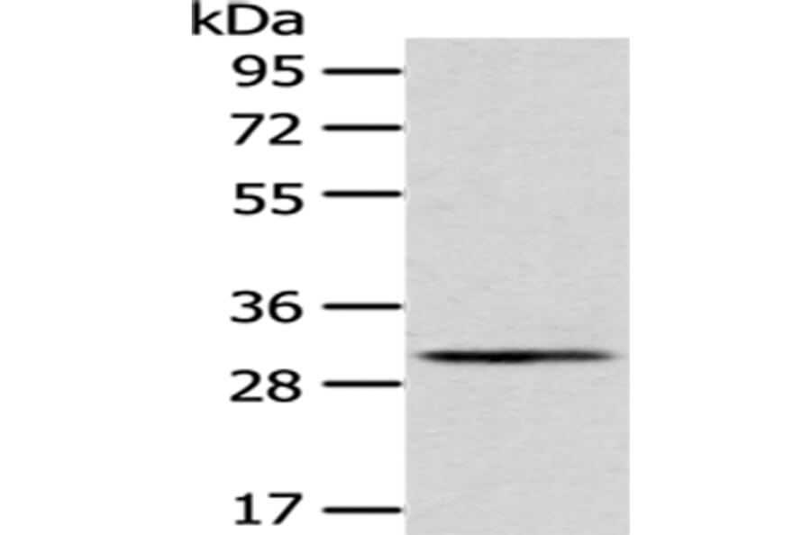 AQP3 Antibody from Signalway Antibody (43394) - Antibodies.com