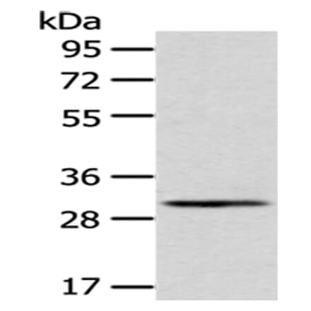 AQP3 Antibody from Signalway Antibody (43394) - Antibodies.com