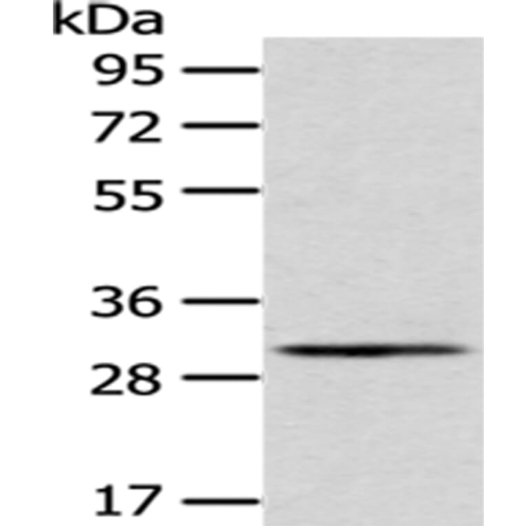 AQP3 Antibody from Signalway Antibody (43394) - Antibodies.com