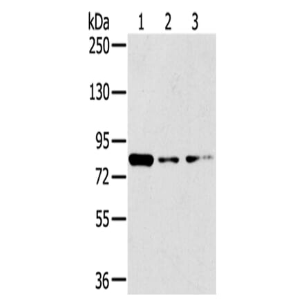GPD2 Antibody from Signalway Antibody (43415) - Antibodies.com