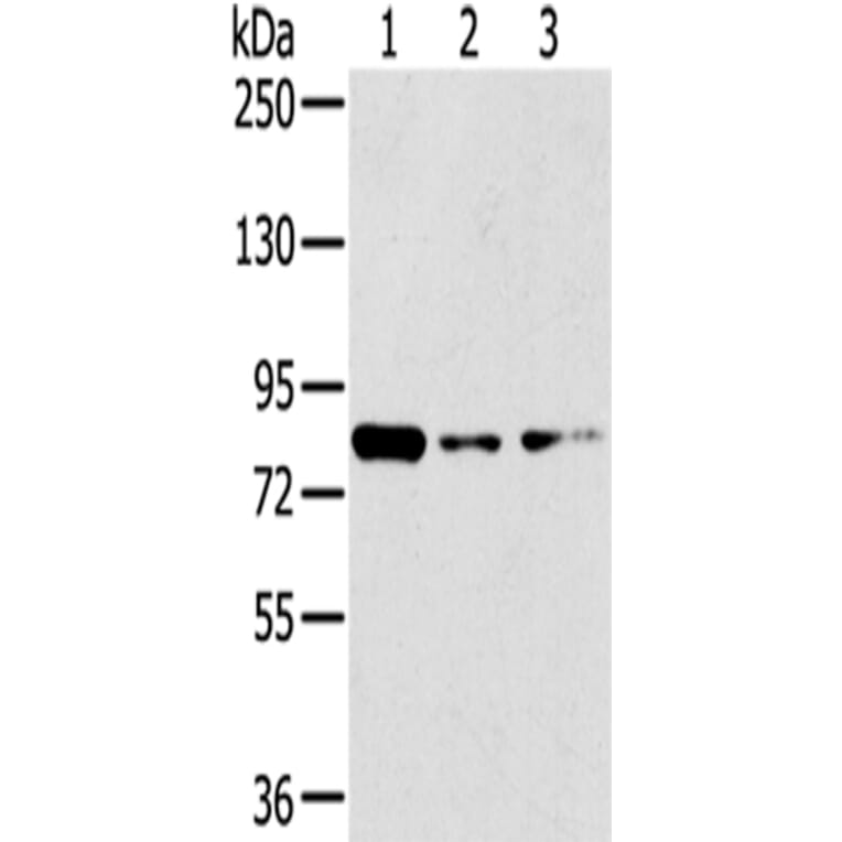 GPD2 Antibody from Signalway Antibody (43415) - Antibodies.com