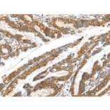 Immunohistochemistry - GPD2 Antibody from Signalway Antibody (43415) - Antibodies.com