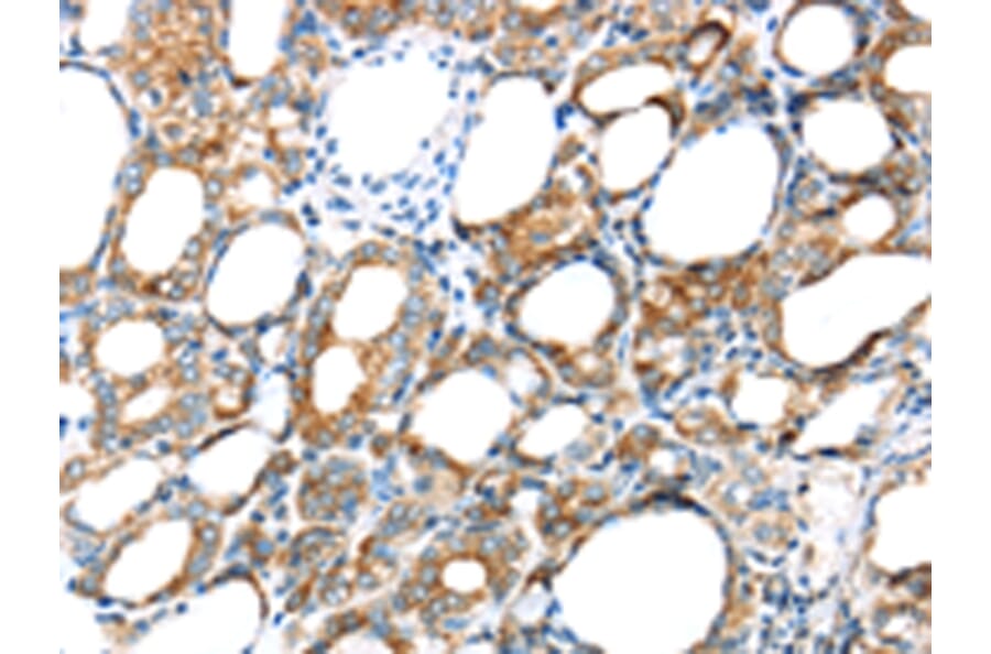 Immunohistochemistry - GPD2 Antibody from Signalway Antibody (43415) - Antibodies.com
