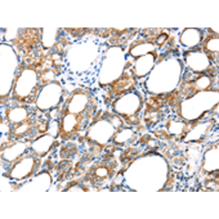Immunohistochemistry - GPD2 Antibody from Signalway Antibody (43415) - Antibodies.com