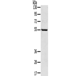 TPH2 Antibody from Signalway Antibody (43424) - Antibodies.com